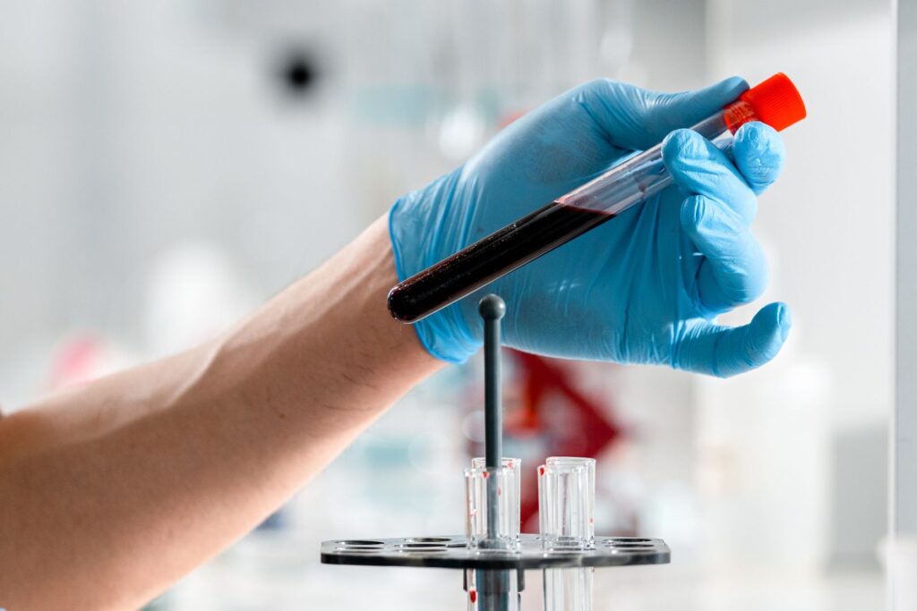 Dłoń w rękawiczce trzyma probówkę z próbką krwi w laboratorium