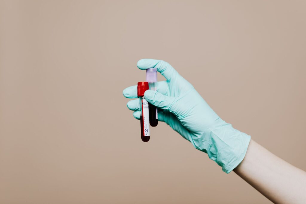 Dłoń w rękawiczce trzymająca probówki z krwią do badań hormonalnych